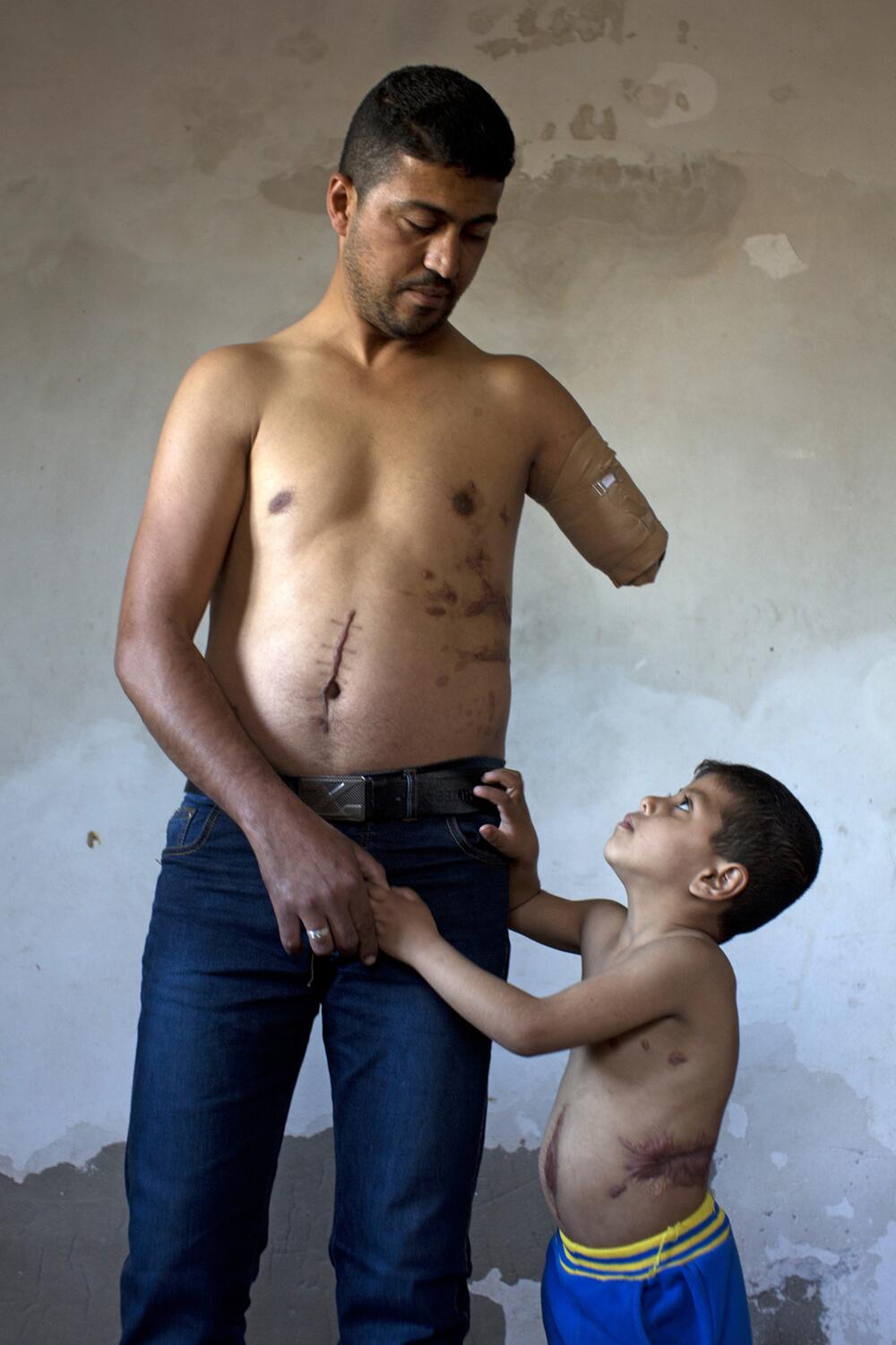 UNICEF-Foto des Jahres 2015